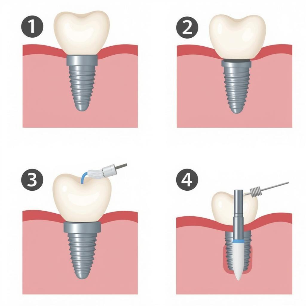 Proper dental implant cleaning techniques